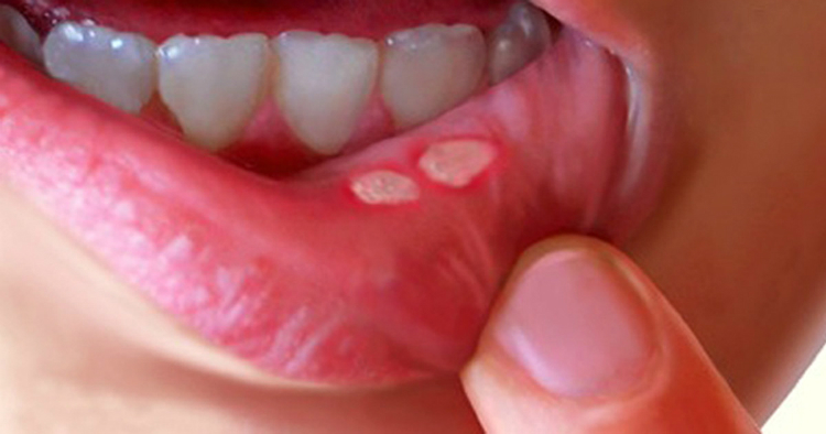 Похожее изображение