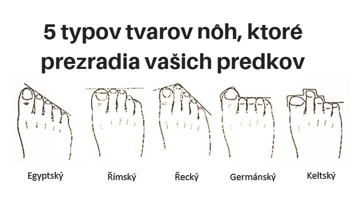 5 typov tvarov nohy, ktoré prezradia vašich predkov