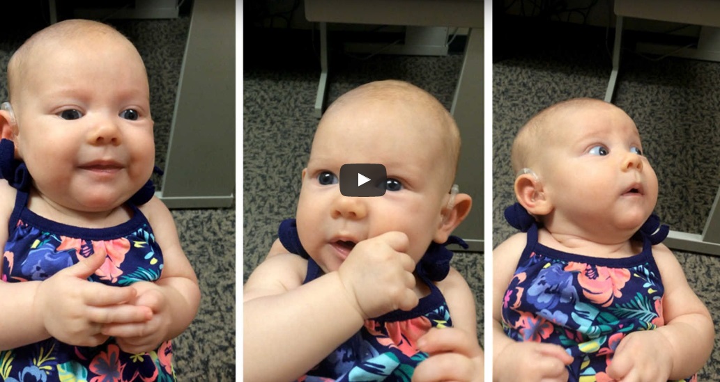malé hluchonemé 3-mesačné dievčatko po nasadení strojčeka konečne počulo svoju mamičku