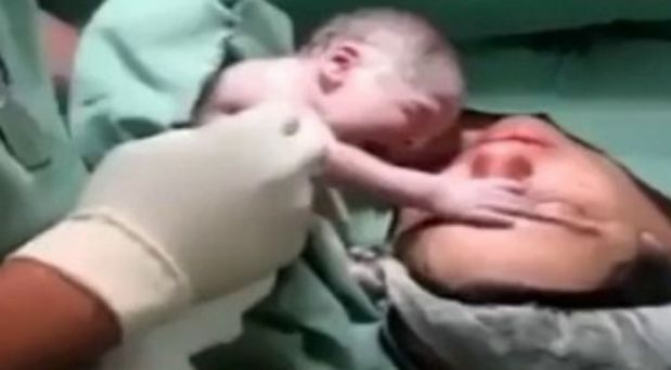 Mamička neprežila pôrod. Keď potom doktori uvideli, čo urobilo novonarodené dieťa, zostali v šoku!