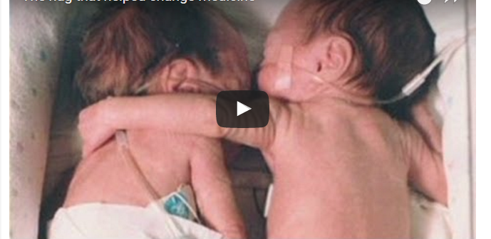 Sestrička dala ťažko choré dieťa k svojmu dvojčaťu do inkubátora. Čo sa stalo potom, vás dostane