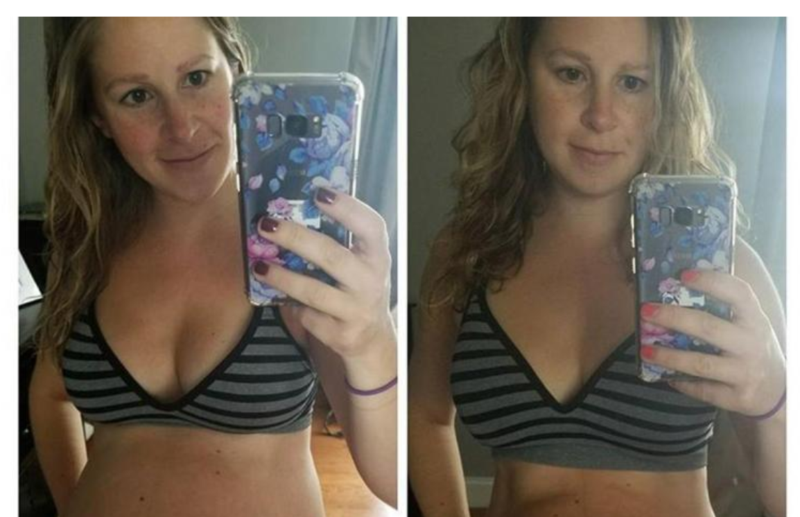 Čerstvá matka zdieľala fotky svojho tela 3 týždne po pôrode. Veľa ľudí ju ale kritozovalo kvôli…
