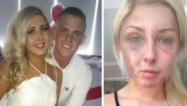 19-ročný muž týral svoju ženu… Chcel, aby zomrela. Len jedna vec jej zachránila život pred istou smrťou