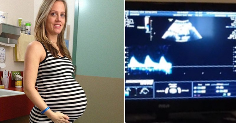 Lekári jej povedali, že čaká dvojičky. Potom si na snímke z ultrazvuku všimli jeden detail…